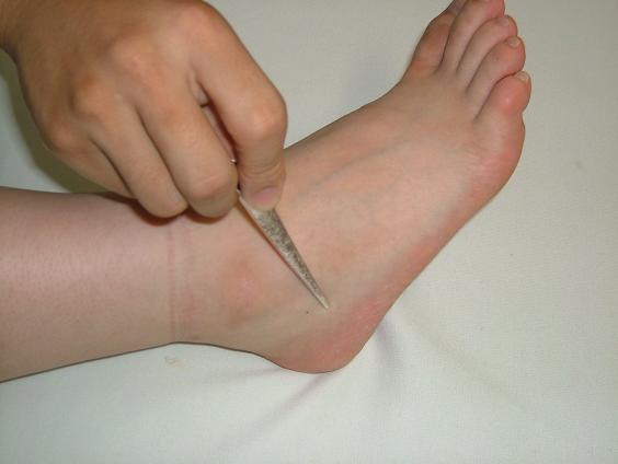 �\�����̎挊�ʐ^